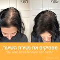 Beauté Beauté Radieuse - המברשת המהפכנית לעיסוי הקרקפת ✅מעל ל - 90% הצלחה בצמיחת שיער מחודשת 