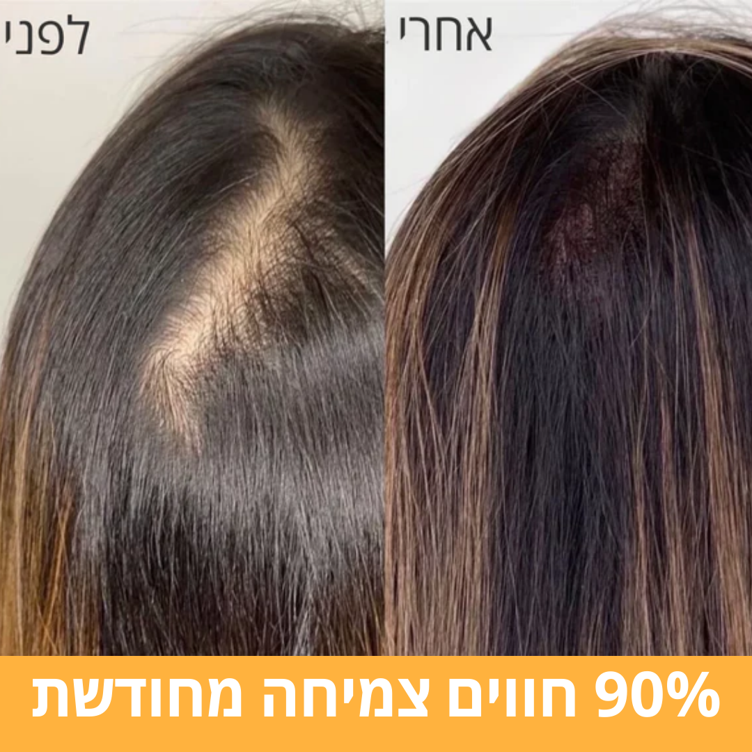 Beauté Beauté Radieuse - המברשת המהפכנית לעיסוי הקרקפת ✅מעל ל - 90% הצלחה בצמיחת שיער מחודשת 